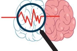 Un mecanismo cerebral podría explicar por qué la obesidad favorece el deterioro cognitivo
